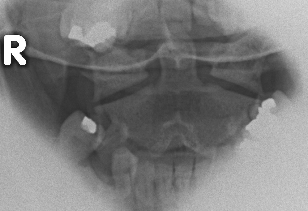 The Cervical Spine